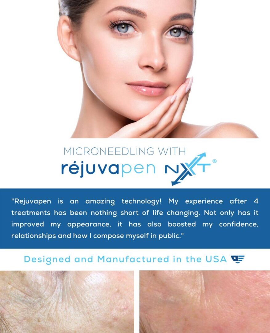 Microneedling with Rejuvapen NXT